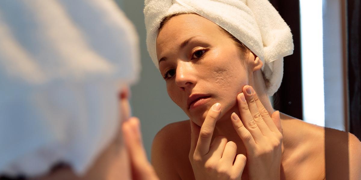 How To Achieve And Maintain Healthy Skin At Home