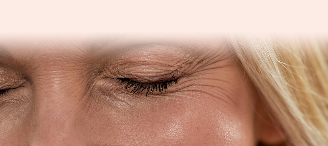 Fine Lines & Wrinkles